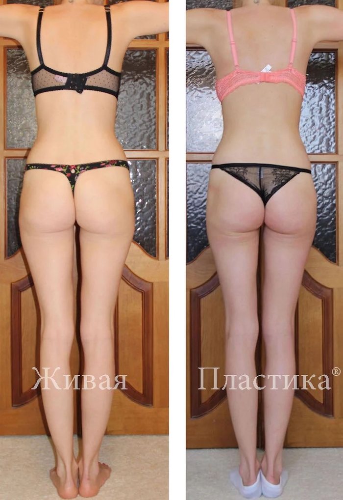 Фото результата 11