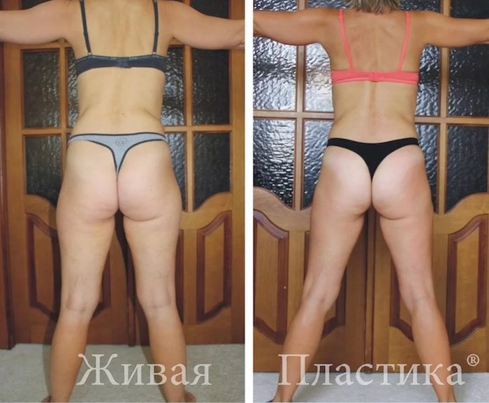 Фото результата 3