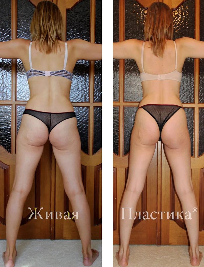 Фото результата 7