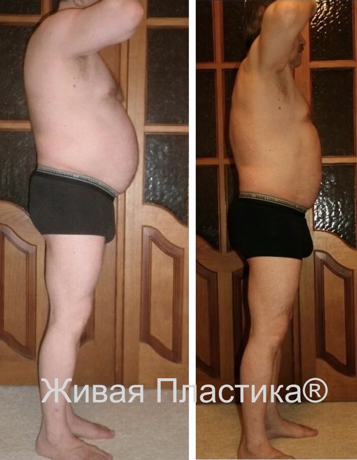 Фото результата клиента